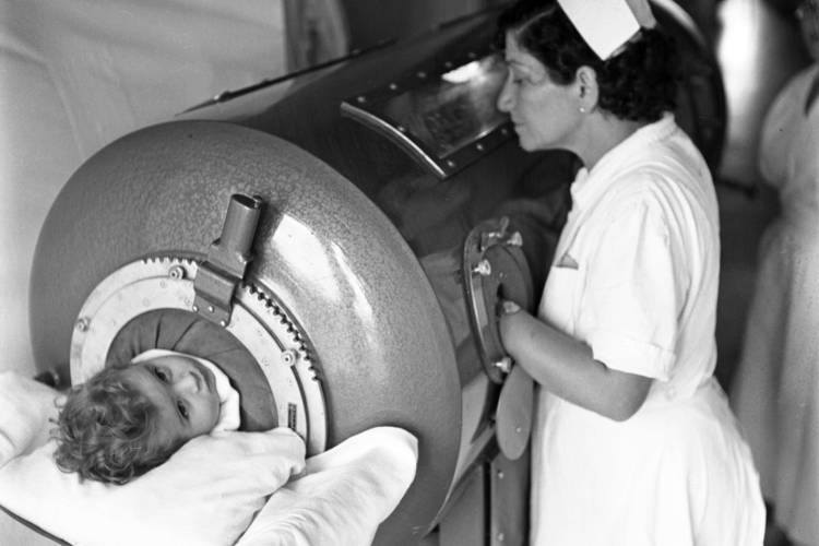 Equipamento conhecido como pulmão de aço ajudava crianças com paralisia a respirar (Foto: OMS/Paul Palmer, 1956)